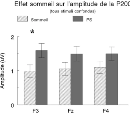 Figure  6 :  Effet  de  la  PS  sur  l’amplitude  de  la  P200.  Valeurs  exprimées  en  moyenne  ±  e.s.m