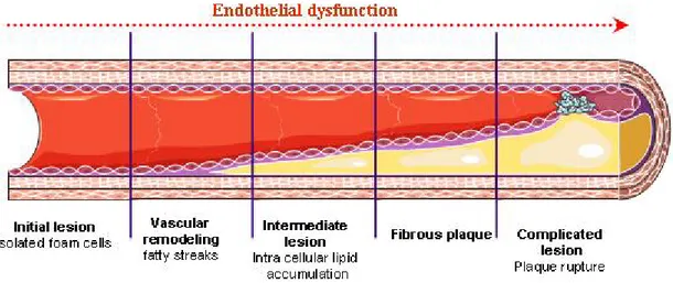 Figure 2-5: Stages of endothelial dysfunction in atherosclerosis. 