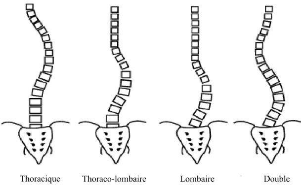 Figure 1 : Classification des  courbes  