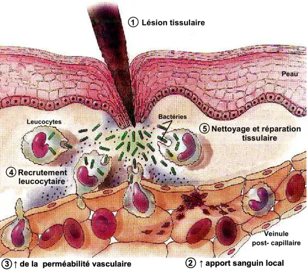 Figure 1 : Les principales étapes de la réaction inflammatoire .  Plusieurs agents  causent  des  dommages  tissulaires  (1)  responsables  de  l’initiation  du  processus  inflammatoire