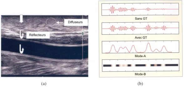 Figure 1.5 – Image ultrasonore mode-B d’une artère (a). L’image est construite à par- par-tir d’interfaces réfléchissantes (flèches blanches) et de diffuseurs (régions encerclées)