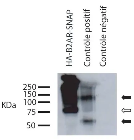 Figure 3.1 Expression de la construction HA- ȕ2AR-SNAP IB réalisé sur des 