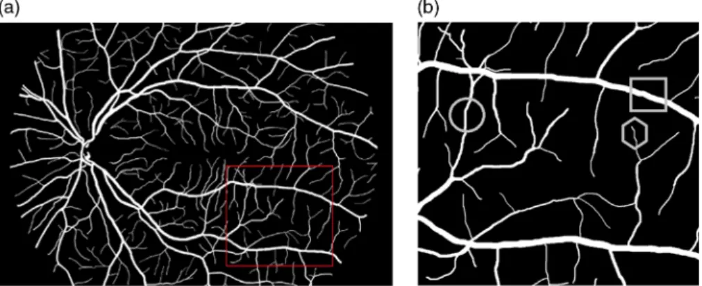 Fig. 1 Example of the three different considered calibers of vessels in the retinal vessels