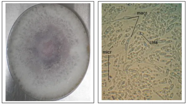 Figure 2b : les conidies du Fusarium  oxysporum f. sp. albedinis sous microscope  optique (×400) ; micr: microconidies, macr:  macroconidies, chla : chlamydospores