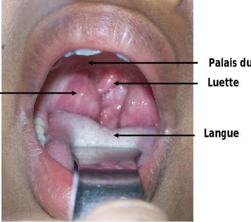 Figure 1  [5]  : Vue antérieure de l’oropharynx 