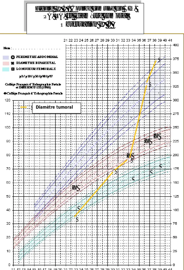 Figure  n° 4 : Courbe cumulée du BIP,  PA, LA,  et  diamètre tumoral