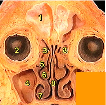 Figure 8 : anatomie générale des sinus. 1) sinus frontal ; 2) orbite ; 3  sinus ethmoïdal ; 4) sinus maxillaire ; 5) cornet supérieur ; 6) cornet  moyen ; 7) cornet inférieur ; 8) cloison