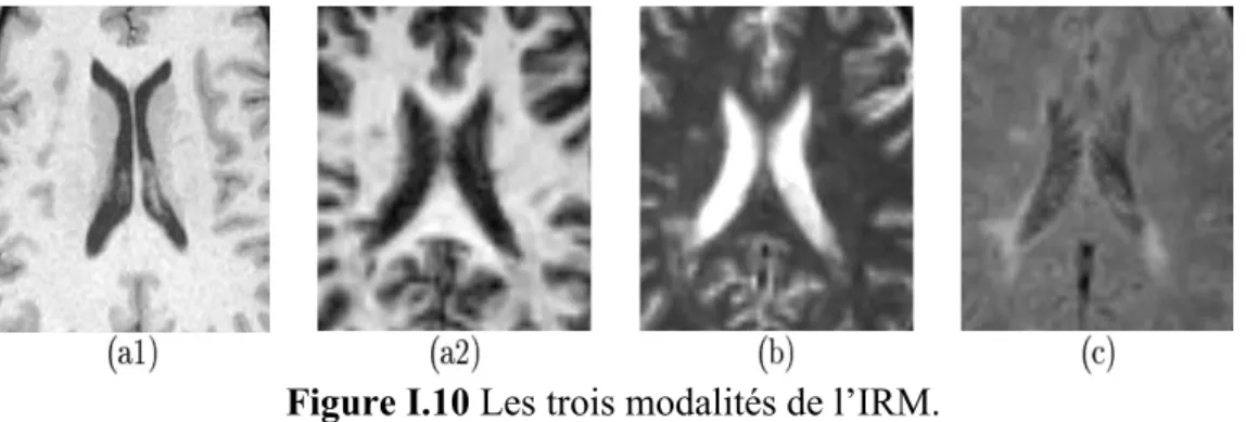 Figure I.10 Les trois modalités de l’IRM.