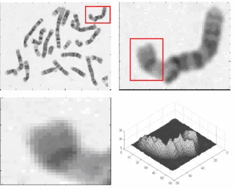 Fig. 4.1  Représentation d'une image à niveau de gris du chromosome et des zooms d'une partie de cette image.