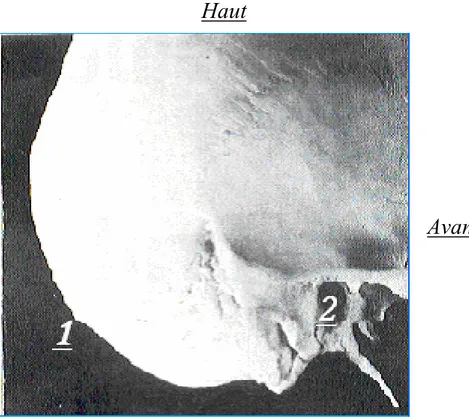 Figure 8 : Repère osseux de la loge cérébrale postérieure. (21) 1. Protubérance occipitale externe.