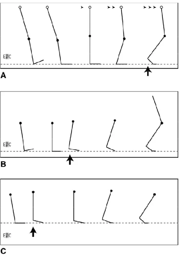 Figure 3 Déroulement du pas en phase d’appui (la flèche noire  Courte matérialise le début du décollement du talon)