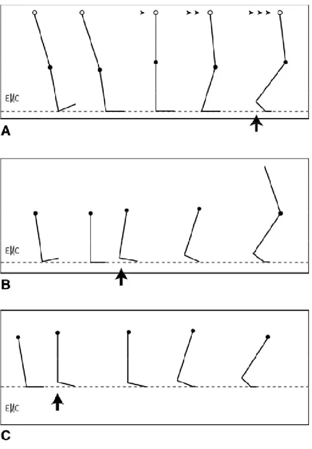 Figure 3 Déroulement du pas en phase d’appui (la flèche noire  Courte matérialise le début du décollement du talon)