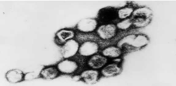 Figure 1a : Structure du virus de la rubéole (microscopie électronique Gx100000) 