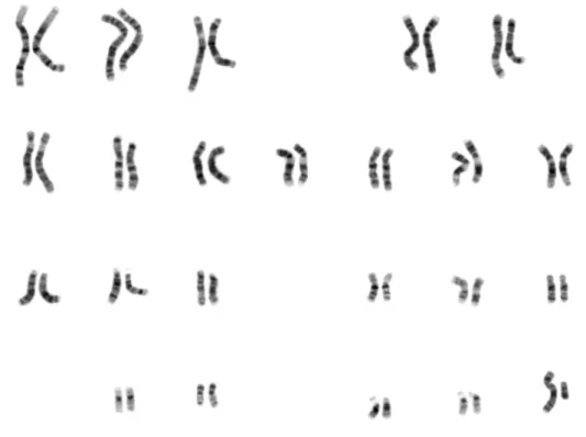 Figure 2.1 Human male karyotype 