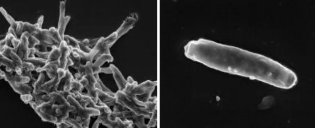 Figure 5. Mycobacterium tuberculosis, agent de la tuberculose, 