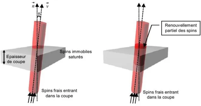 Figure 1.8 :illustration schématique de l’effet « inflow » communément   utilisé en angiographie par temps de vol