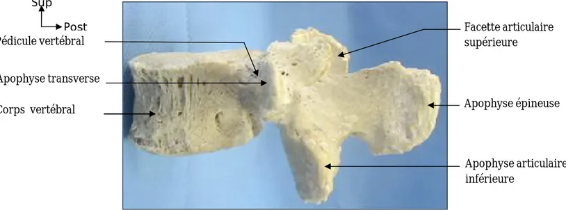 Figure 2 : Vue latérale d’une vertèbre lombaire  (Laboratoire d’Anatomie FMPF).  Apophyse épineuse  Apophyse articulaire inférieure Facette articulaire supérieure Apophyse transverse Corps  vertébral Pédicule vertébral 
