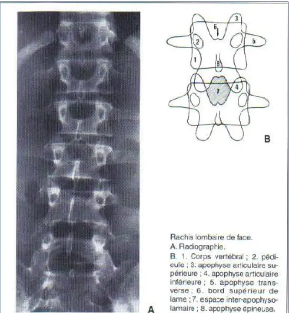 Figure 6 : Radioanatomie de l’incidence de face de la radiographie standard [9]. 