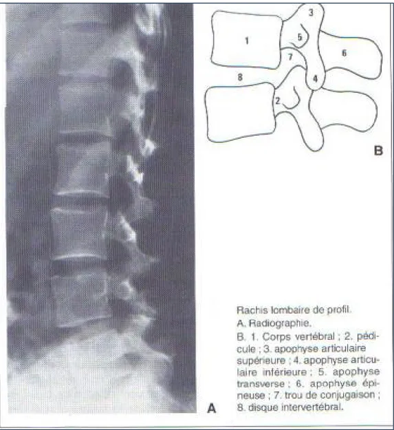 Figure 7: Radioanatomie de l’incidence latérale de la radiographie standard [9]. 