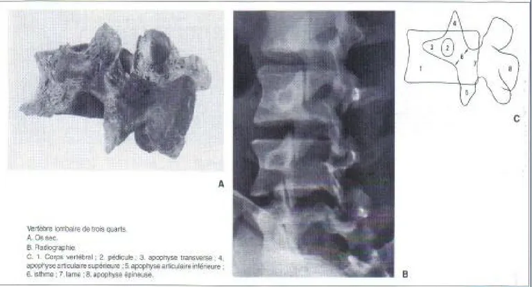 Figure 8 : Radioanatomie de l’incidence oblique de la radiographie standard [9].  