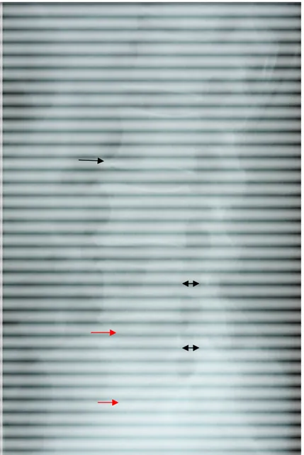 Figure 11: Radiographie standard du rachis lombaire de profil montrant une  rectitude du rachis, une brièveté des pédicules (double flèche), un pincement  discal en L4-L5 et en L5-S  (flèche rouge) et une ostéophytose antérieure (flèche 
