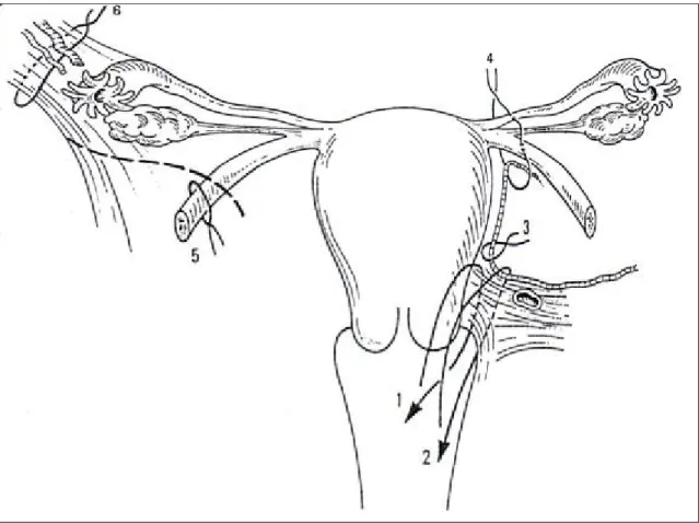 Figure 1 : hystérectomie vaginale : principe de l’intervention et  succession des hémostases préventives