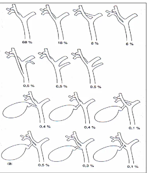 Figure    6 6 6 6    ::::             variations anatomiques des voies biliaires  (12) 