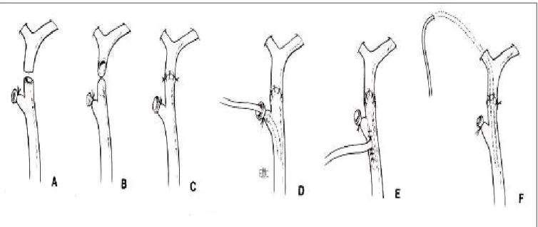 Figure n°Figure n°Figure n°