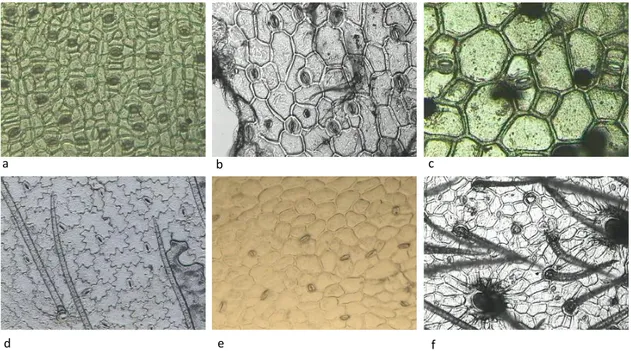 Figure 5.  Photos microscopiques des cuticules des feuilles de quelques espèces (grossissement  x100)