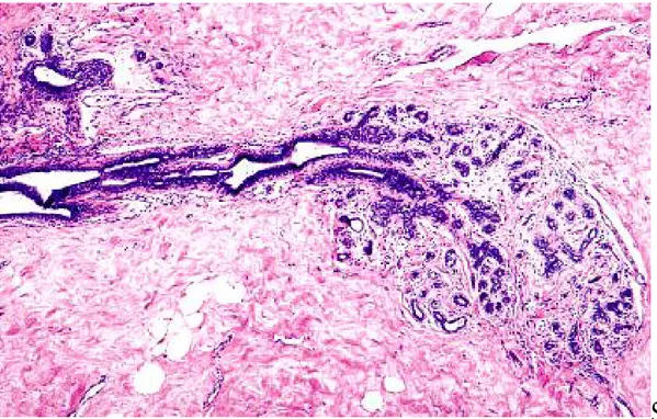 Figure 4 : microphotographie d'une unité terminale ductulo-lobulaire  comme vue dans un tissu mammaire normal 