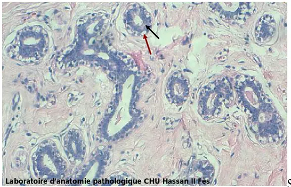Figure 5 : microphotographie d'un tissu mammaire normal comportant des acini et  des ductules tapissés par une double assise cellulaire 