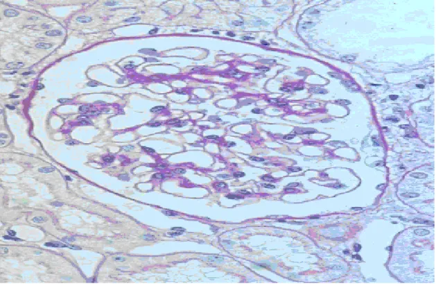 Figure 1: glomérulonéphrite classe I en microscope optique  (Hôpital HFME Lyon 2009) 