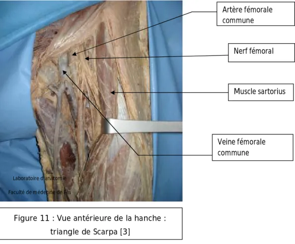 Figure 11 : Vue antérieure de la hanche :  triangle de Scarpa [3] 