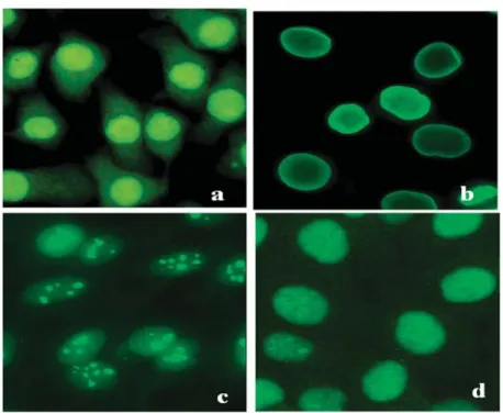 Figure  2.  Exemples  des  aspects  de  l’immunofluorescence  de  type  AAN  dans  des  cellules Hela