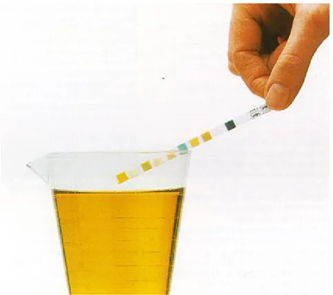 Figure 7 : Bandelette urinaire utilisée au cours du dépistage. 