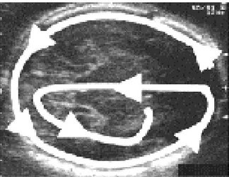 Figure 3 : Technique d’examen du cerveau fœtal (3) 