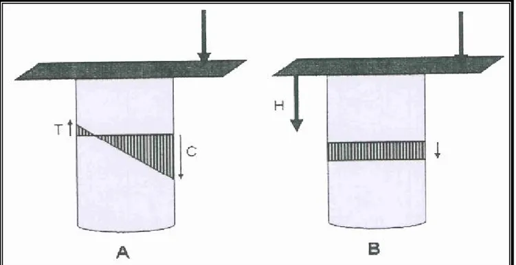 Figure 1 : Les contraintes crées par une charge asymétrique selon PAUWELS 