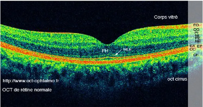 Figure 16 : OCT d’une rétine normale [42].  FO : Couche des fibres optiques. 