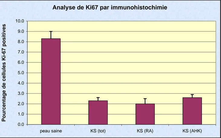 Figure 6. Résultats de l'analyse de Ki67 par immunohistochimie. Analyse statistique ANOVA  (Bonferroni) : *** correspond à une différence significative avec p&lt;0.001