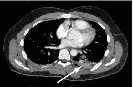 Figure 2bis 