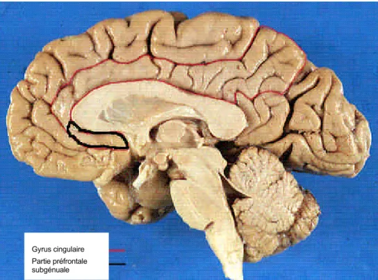 Figure 1.3e : Le cortex cingulaire et sa partie préfrontale subgénuale. Gyrus cingulaire 