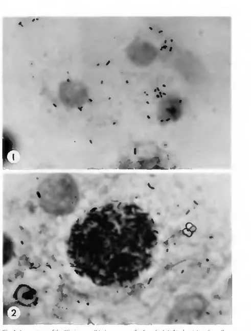 Fig. I. Appearance of the &#34;Sw iss agent** in hemocytes of infected aduli Ixodes ricinus troni Staats- Staats-wald (Bern) i G imenei stain
