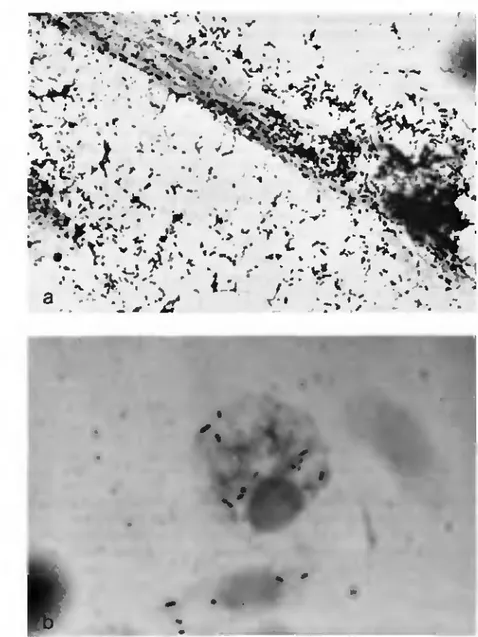 Fig. 2. Microorganismes de type rtckettsien Jans Ixodes ritmili. C oloration: G imene/.