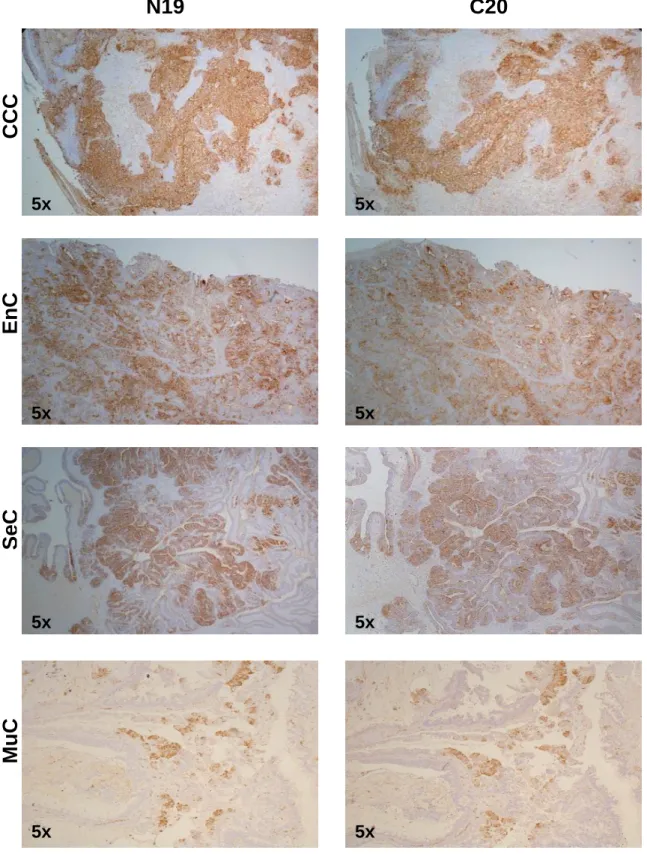 Figure 6. Different expression levels of BARD1 in different pathological type of ovarian 