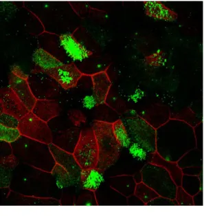Figure 7: Confocal microscopic images of reconstituted nasal epithelial cells showing  expression of ezrin (green) and F-actin network (red) delineating the cell outline after  treatment with 0.05% Sodium Hypochlorite solution (prepared with PBS) exposed f