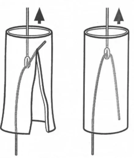 Fig. 9 : lésion de l’œsophage (23) 