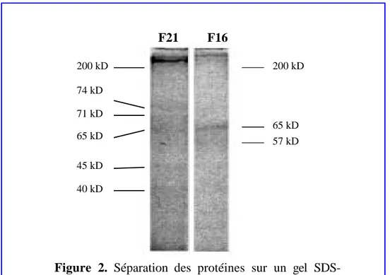Figure  2.  Séparation  des  protéines  sur  un  gel  SDS- SDS-polyacrylamide  de  deux  fractions  F21  et  F16  de