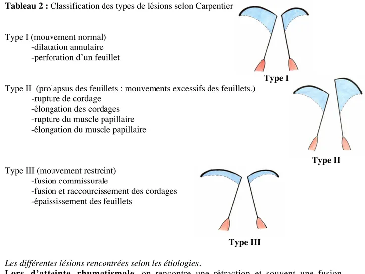 Tableau 2 : Classification des types de lésions selon Carpentier