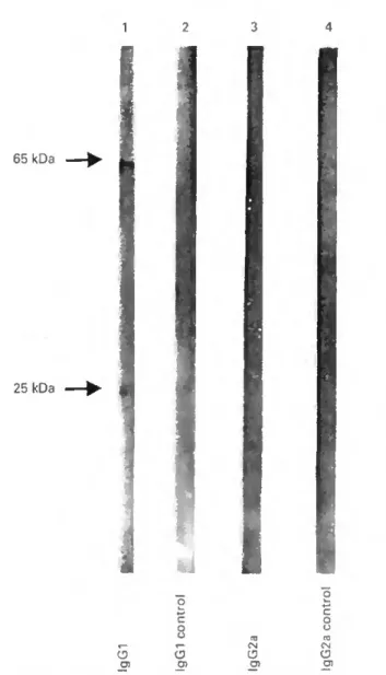Figure 5 SDS-PAGE analysis of SGE (lane I). saliva (lane 2) and  chromatographic frictions K)