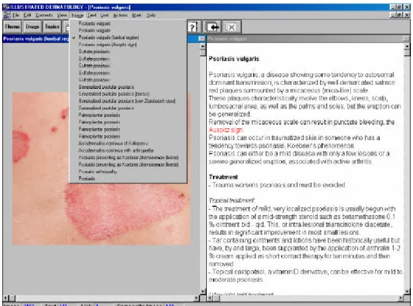 Fig. II-12: Illustrated Dermatology : les informations s'affichent dans différents cadres automatiquement réajustés 